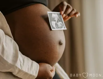 echofoto zwangerschapsaankondiging.png echofoto zwangerschapsaankondiging.png